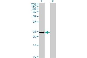 Western Blot analysis of HYAL1 expression in transfected 293T cell line by HYAL1 MaxPab polyclonal antibody. (HYAL1 antibody  (AA 1-253))