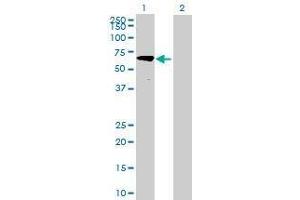 Lane 1: LOC26010 transfected lysate ( 54. (DNAPTP6 293T Cell Transient Overexpression Lysate(Denatured))