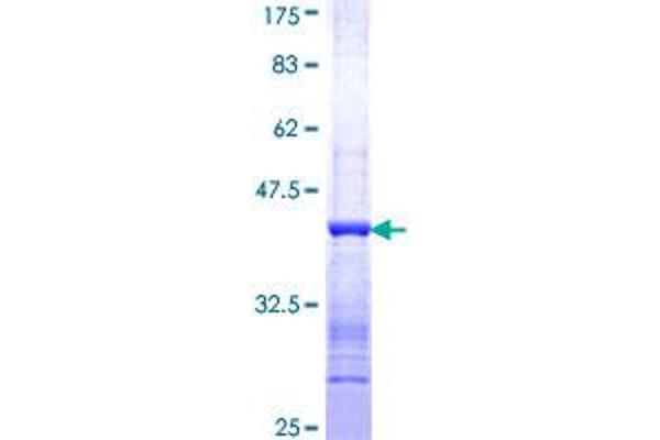 MEK2 Protein (AA 291-400) (GST tag)