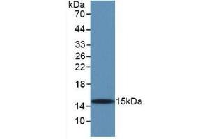 Detection of Recombinant TGFb1, Human using Monoclonal Antibody to Transforming Growth Factor Beta 1 (TGFb1) (TGFB1 antibody  (AA 279-390))