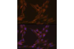 Immunofluorescence analysis of NIH-3T3 cells using KIFC1 Rabbit mAb (ABIN1680485, ABIN3015039, ABIN3015040 and ABIN7101305) at dilution of 1:100 (40x lens). (KIFC1 antibody)