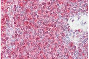 Anti-MTOR antibody IHC staining of human spleen. (MTOR antibody  (AA 2415-2464))
