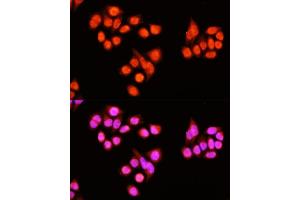 Immunofluorescence analysis of Hela cells using ZNF408 antibody  at dilution of 1:100 (40x lens). (ZNF408 antibody  (AA 1-240))
