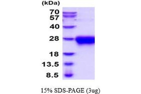 ACVR2A Protein (AA 20-135) (His tag)