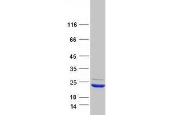 XAGE2 Protein (Myc-DYKDDDDK Tag)