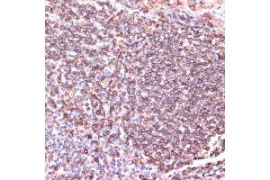 Immunohistochemistry of paraffin-embedded human tonsil using TPD52 antibody  at dilution of 1:100 (40x lens). (TPD52 antibody  (AA 1-184))