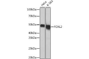 Western blot analysis of extracts of various cell lines, using FOXL2 Rabbit mAb (ABIN1682615, ABIN7101527, ABIN7101528 and ABIN7101529) at 1:1000 dilution. (FOXL2 antibody)