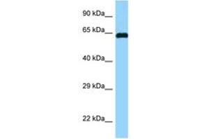 Image no. 1 for anti-Abl-Interactor 1 (ABI1) (AA 122-171) antibody (ABIN6748110) (ABI1 antibody  (AA 122-171))