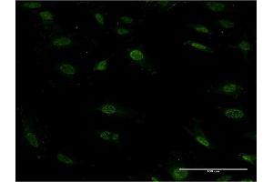 Immunofluorescence of monoclonal antibody to ZEB2 on HeLa cell. (ZEB2 antibody  (AA 1115-1214))