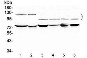 Western blot testing of 1) rat testis, 2) mouse testis, 3) human HeLa, 4) human A549 and 6) human SK-OV-3 lysate with NFATC4 antibody at 0. (NFATC4 antibody)