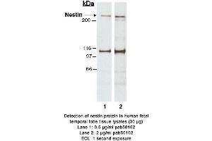 Image no. 1 for anti-Nestin (NES) (AA 1464-1614) antibody (ABIN363471) (Nestin antibody  (AA 1464-1614))