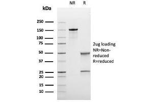 SDS-PAGE Analysis Purified BCL-6 Mouse Recombinant Monoclonal Antibody (rBCL6/1718). (Recombinant BCL6 antibody  (AA 256-389))