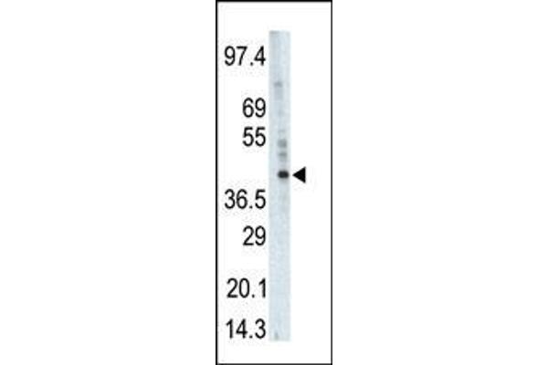 PHKG1 antibody  (AA 302-332)