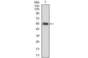 Western blot analysis using CD38 mAb against human CD38 (AA: Extra(43-300)) recombinant protein. (CD38 antibody  (AA 43-300))