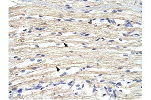 FBXL11 antibody was used for immunohistochemistry at a concentration of 4-8 ug/ml to stain Skeletal muscle cells (arrows) in Human Muscle. (KDM2A antibody  (N-Term))
