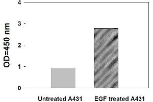 Image no. 3 for Signal Transducer and Activator of Transcription 3 (Acute-Phase Response Factor) (STAT3) ELISA Kit (ABIN1981729) (STAT3 ELISA Kit)