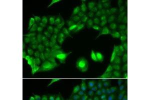 Immunofluorescence analysis of HeLa cells using SSX2 Polyclonal Antibody (SSX2 antibody)
