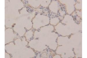 Detection of TM in Rat Lung Tissue using Polyclonal Antibody to Thrombomodulin (TM) (Thrombomodulin antibody  (AA 324-480))