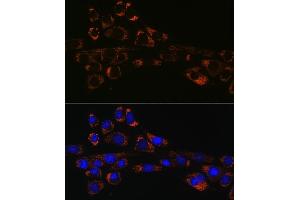 Immunofluorescence analysis of NIH-3T3 cells using HSP47/SERPINH1 Rabbit mAb (ABIN7270238) at dilution of 1:100 (40x lens). (SERPINH1 antibody)