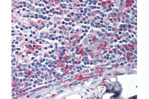 Anti-FCGR1A / CD64 antibody IHC staining of human tonsil. (FCGR1A antibody)