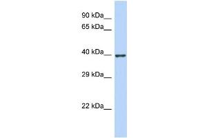 Host:  Rabbit  Target Name:  ZNF607  Sample Type:  Jurkat Whole Cell lysates  Antibody Dilution:  1. (ZNF607 antibody  (N-Term))
