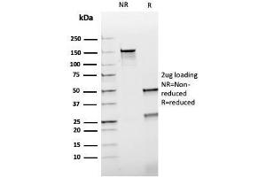 SDS-PAGE (SDS) image for anti-Heat Shock 60kDa Protein 1 (Chaperonin) (HSPD1) antibody (ABIN6939669)