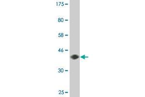 Western Blot detection against Immunogen (36. (DYRK2 antibody  (AA 1-100))