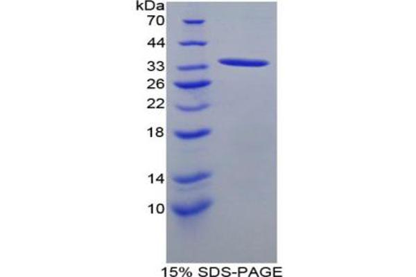 ANGPTL1 Protein