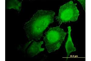 Immunofluorescence of monoclonal antibody to HCLS1 on HeLa cell. (HCLS1 antibody  (AA 266-355))