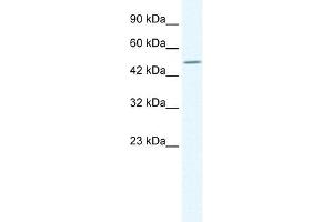 TPTE antibody used at 1. (TPTE antibody  (C-Term))