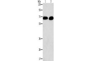 Western Blotting (WB) image for anti-Protein Kinase C, alpha (PKCa) antibody (ABIN2434184) (PKC alpha antibody)