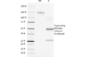 SDS-PAGE Analysis Purified CD7 Mouse Monoclonal Antibody (C7/511). (CD7 antibody)