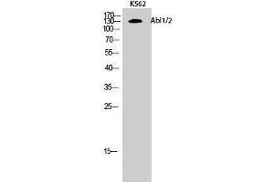 Western Blotting (WB) image for anti-Abelson Murine Leukemia Viral Oncogene Homolog 1/2 (ABL1/ABL2) (Lys5) antibody (ABIN6283590) (ABL1/2 antibody  (Lys5))