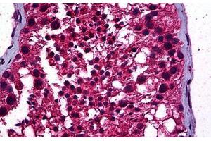 Human Testis: Formalin-Fixed, Paraffin-Embedded (FFPE) (STAT4 antibody  (AA 1-749))