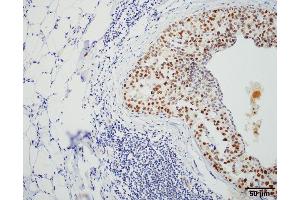 Immunohistochemistry analysis using Rat Anti-HSF1 Monoclonal Antibody, Clone 4B4 . (HSF1 antibody  (AA 425-439) (PE))