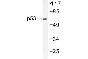 Image no. 1 for anti-Tumor Protein P53 (TP53) antibody (ABIN271768) (p53 antibody)