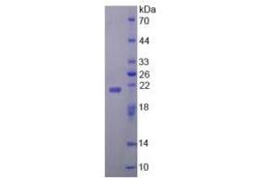 SDS-PAGE analysis of Human ZBP1 Protein. (ZBP1 Protein)