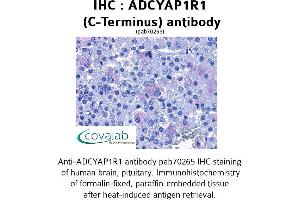 Image no. 1 for anti-Adenylate Cyclase Activating Polypeptide 1 (Pituitary) Receptor Type I (ADCYAP1R1) (C-Term) antibody (ABIN1731539) (ADCYAP1R1 antibody  (C-Term))