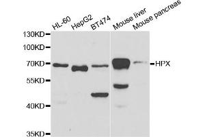 Western Blotting (WB) image for anti-Hemopexin (HPX) antibody (ABIN1876804) (Hemopexin antibody)