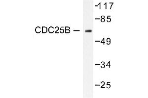 Image no. 1 for anti-Cell Division Cycle 25 Homolog B (S. Pombe) (CDC25B) antibody (ABIN265341) (CDC25B antibody)