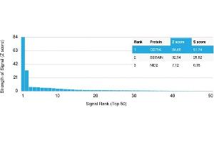 Analysis of Protein Array containing more than 19,000 full-length human proteins using CD79a Rabbit Recombinant Monoclonal Antibody (IGA/1790R). (Recombinant CD79a antibody  (AA 202-216))