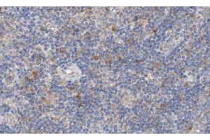 ABIN6266885 at 1/100 staining human lymph node tissue sections by IHC-P. (EGR1 + EGR2 antibody)