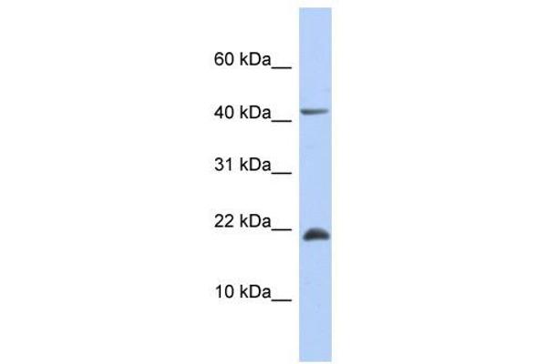 SFRS12IP1 antibody  (Middle Region)