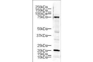 Western blot using  Affinity Purified anti-LIM Kinase antibody shows detection of a 73 kDa band corresponding to LIM kinase in lysates from mouse brain. (LIM Domain Kinase 1 antibody  (AA 630-647))