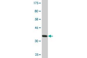 Western Blot detection against Immunogen (37. (MBTPS2 antibody  (AA 312-418))