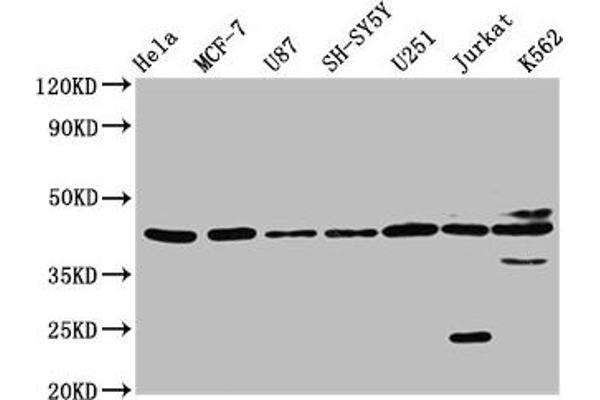 NPY2R antibody  (AA 326-381)