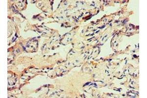 Immunohistochemistry of paraffin-embedded human placenta tissue using ABIN7156485 at dilution of 1:100 (Integrin beta 3 antibody  (AA 609-788))