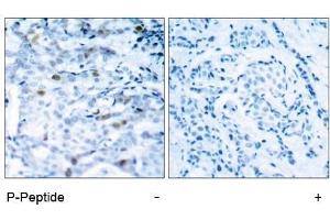 Image no. 1 for anti-Cyclin-Dependent Kinase 1 (CDK1) (pThr161) antibody (ABIN196846) (CDK1 antibody  (pThr161))