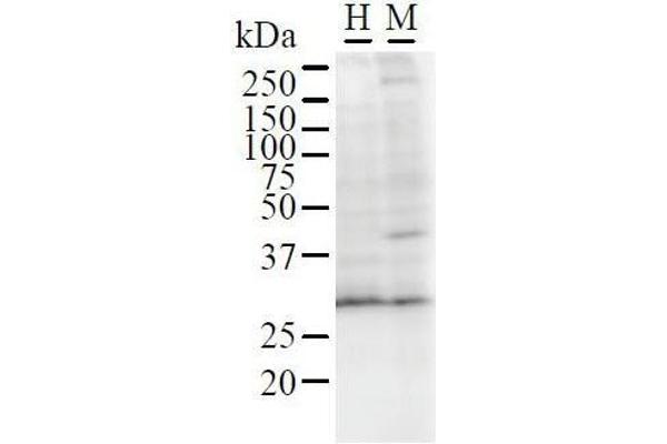 GATAD1 antibody