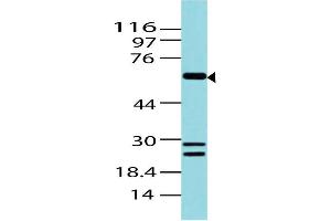 Image no. 1 for anti-B-Cell CLL/lymphoma 6 (BCL6) (AA 203-429) antibody (ABIN5027054) (BCL6 antibody  (AA 203-429))